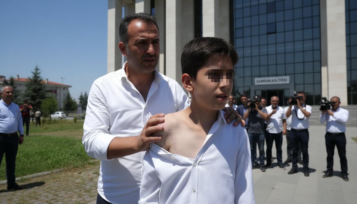 Samsun'da köpek saldırısına uğrayan 12 yaşındaki Yunus'un davasında ilk duruşma: 'Adaletin yerini bulmasını istiyorum'