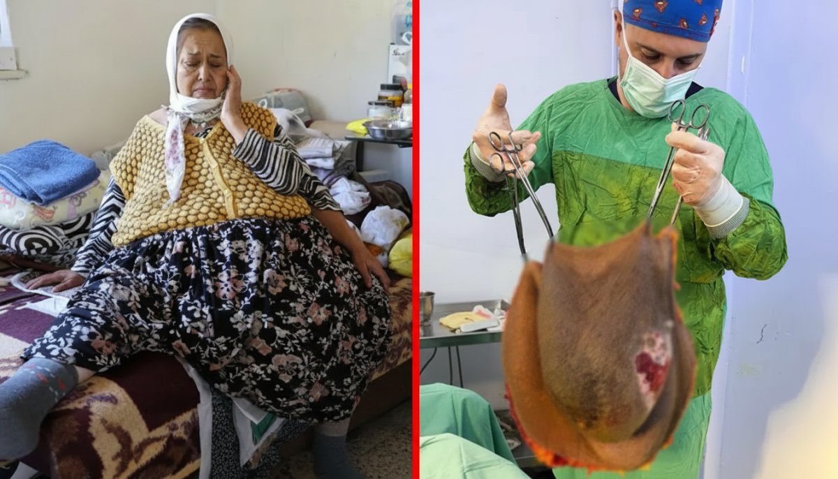 Karnından 40 Kilo Kitle Çıkan Leyla Demirkafa Ameliyatla Sağlığına Kavuştu