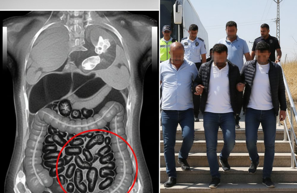 Batman'da 4 Yolcunun Midesinden 353 Parça Uyuşturucu Çıktı