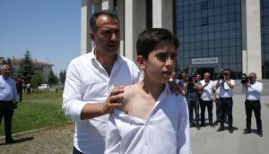 Samsun'da köpek saldırısına uğrayan 12 yaşındaki Yunus'un davasında ilk duruşma: 'Adaletin yerini bulmasını istiyorum'