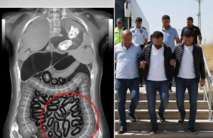 Batman'da 4 Yolcunun Midesinden 353 Parça Uyuşturucu Çıktı